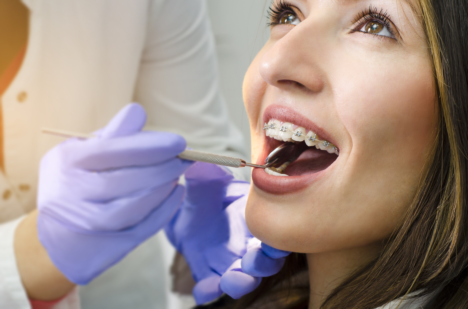 The Step by Step Process of Getting Braces